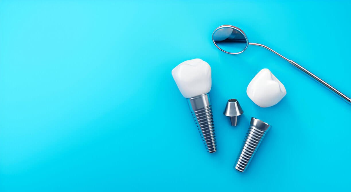 How to Get Dental Implants Covered by Medical Insurance